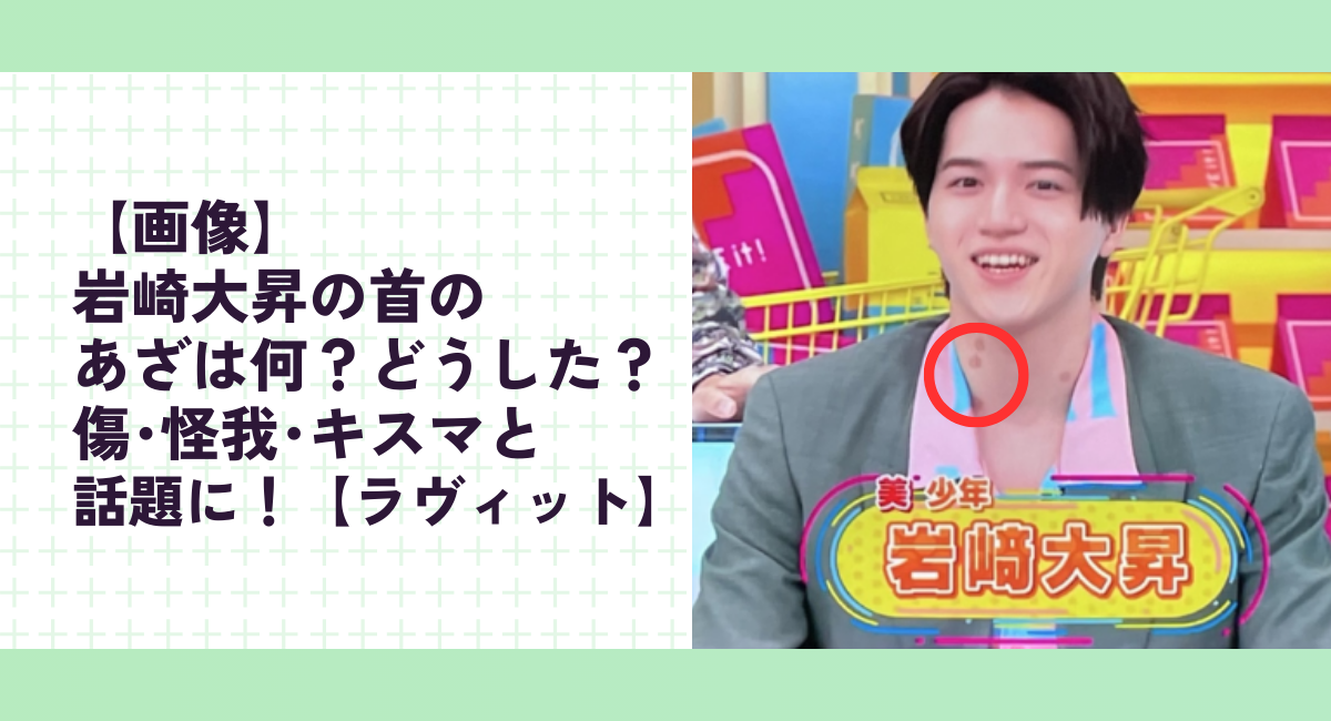 【画像】岩崎大昇の首のあざは何？どうした？傷･怪我･キスマと話題に！【ラヴィット】